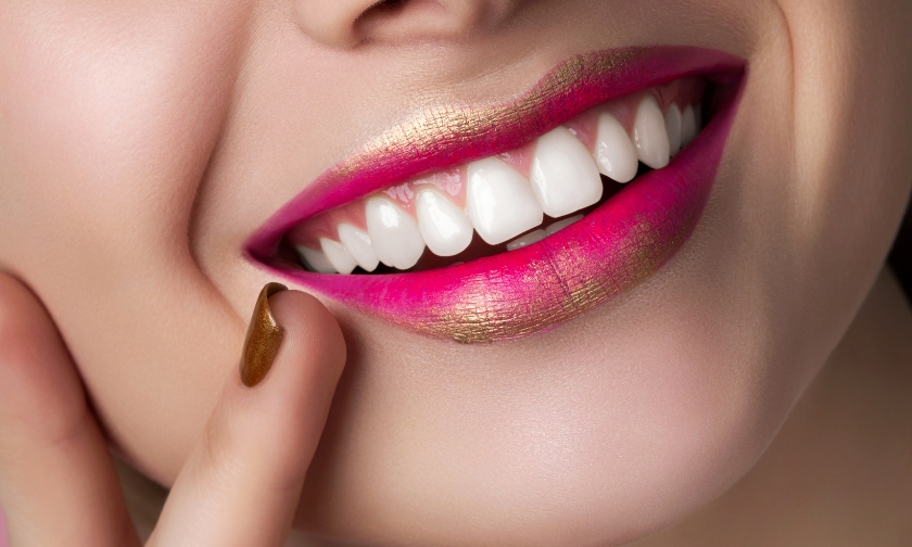 smile makeovers for iowa city's