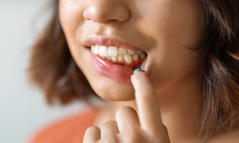 How Do You Prevent Gum Disease: Top Tips From Dr. Shaan Desai